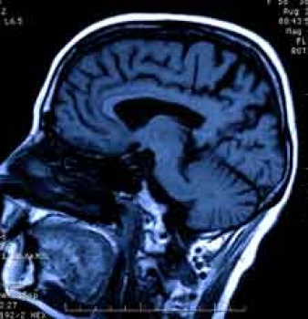 Epstein-Barr virus oorzaak ontstekingen brein
